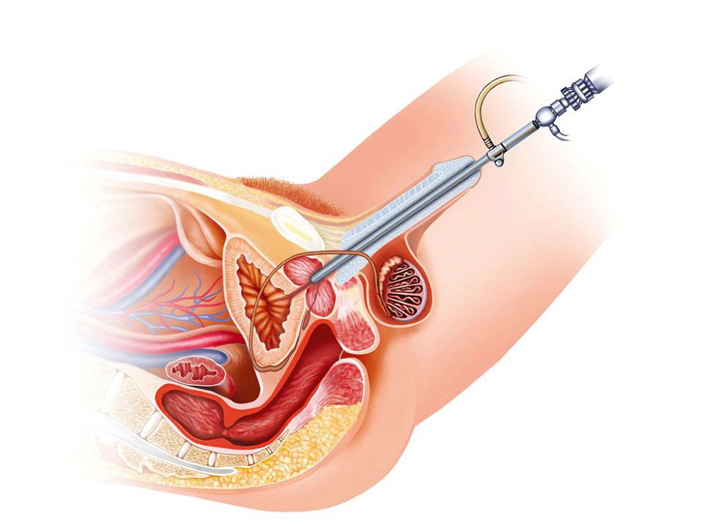 Pathology of the cervix. Diagnostics and treatment